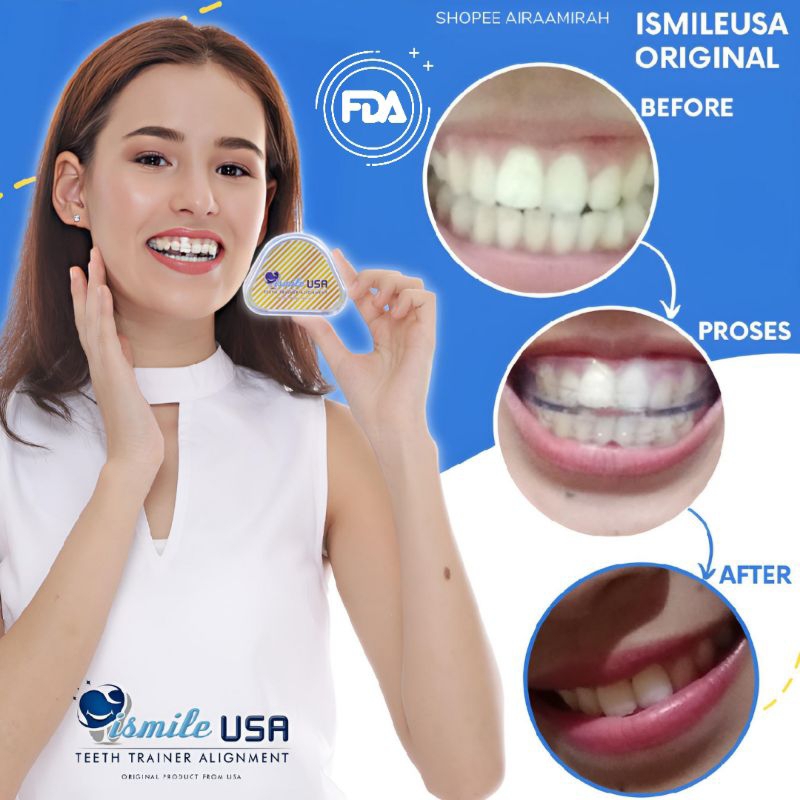 Garansi 100% Ismile USA Original / Perapih Gigi Original Ismileusa / Perapi gigi original / Teeth Tr