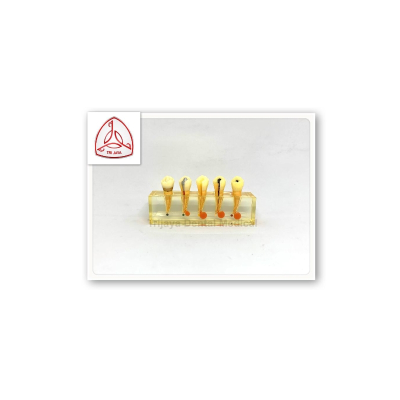 Trijaya Dental Medical Model Gigi konservasi  #4007-2/ Phantum Gigi Konservasi