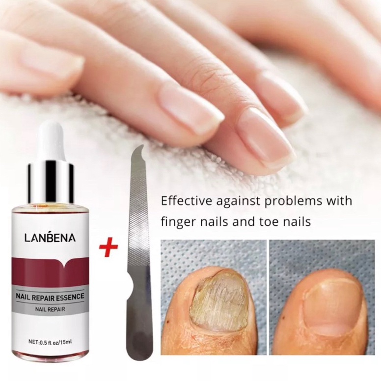 KODE D62O Lanbena Nail Repair Essence Serum Perawatan Jamur Kuku Lanbena Nail Repair Essence