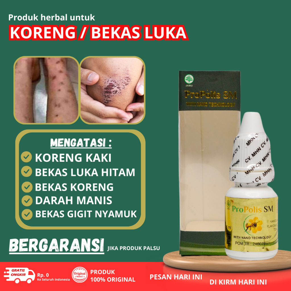 Obat Korengan di kaki - Obat Borok di kaki - Obat Budug / Budugan di kaki - Obat Penghilang koreng