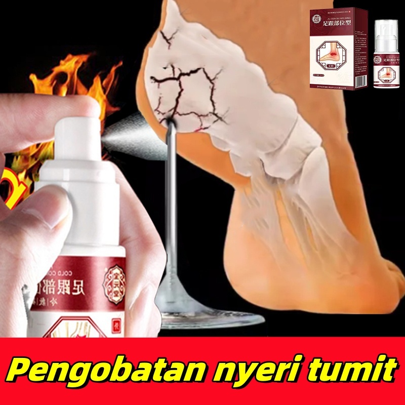 Terapi Kaki Obat Sakit Kaki Plantar Fasciitis Obat Sakit Tumit Pain Killer Spray Nyeri Tumit Kaki Tu