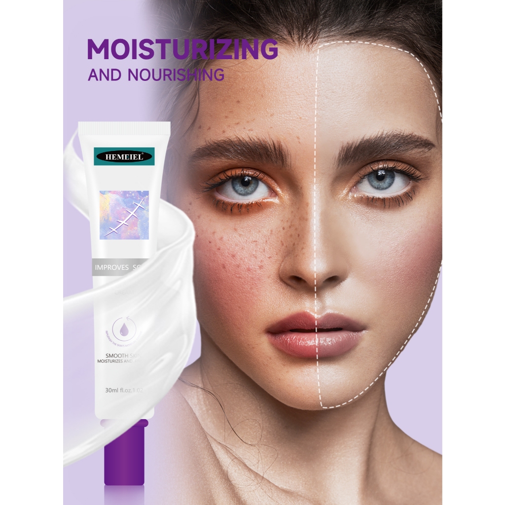 Hemeiel - Scar Cream Removal Krim Penghilang scar bopeng bekas luka lama baru Old Scar Remover Cream