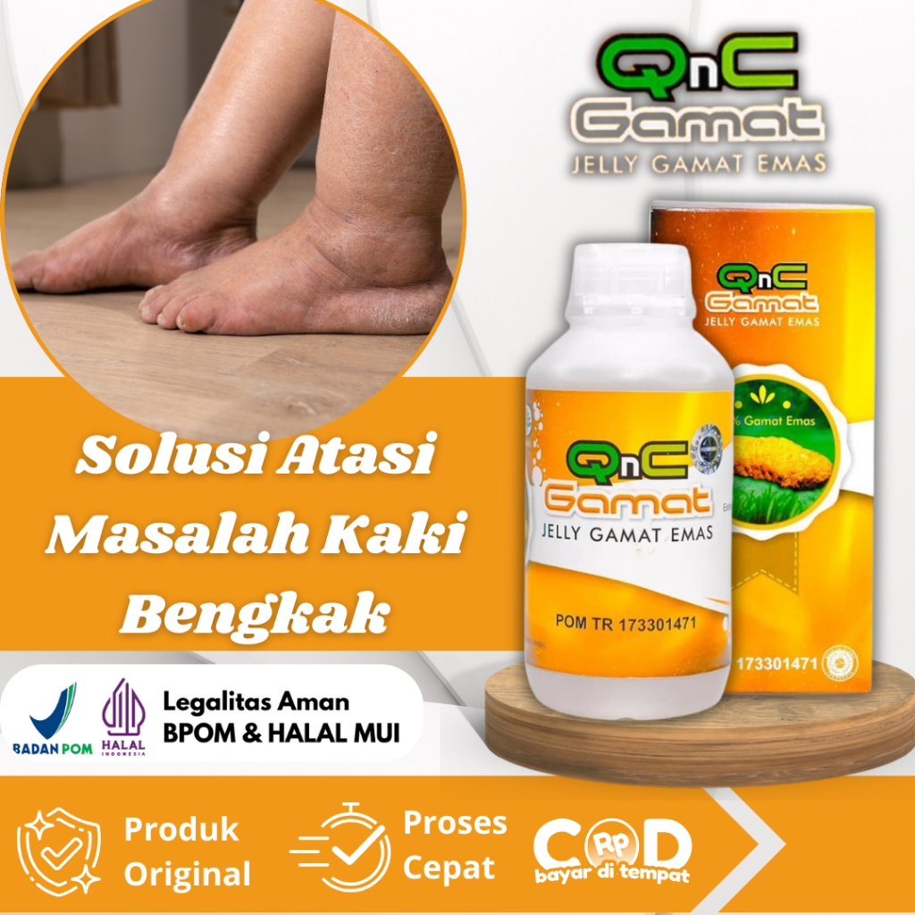 Obat Kaki Bengkak, Kaki Bengkak dan Nyeri, Kaki Bengkak Ibu Hamil, Kaki Bengkak Karena Jatuh, Sakit 
