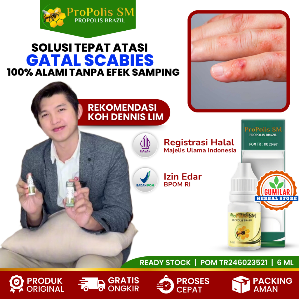 OBAT TETES GATAL SCABIES PADA MANUSIA - OBAT SCABIES GATAL GUDIK - OBAT SCABIES MANUSIA (BPOM RI & H
