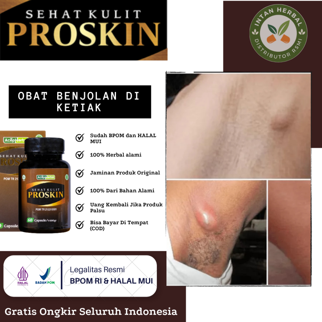 Obat Benjolan Di Ketiak, Benjolan Ketiak Di Kiri / Kanan, Benjolan Kista Di Ketiak, Bisul Di Ketiak,