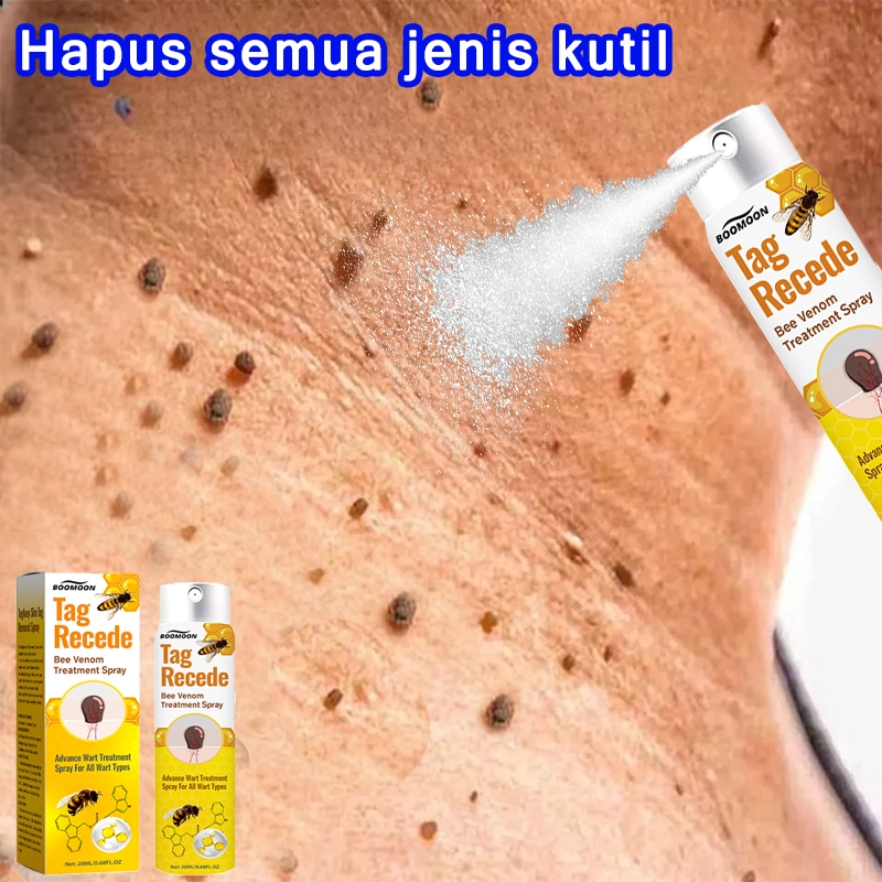 penghilang kutil dan tahi lalat semprotan obat kutil dan tahi lalat  penghilang kutil ampuh obat kut