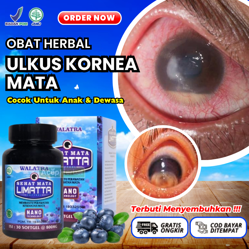 Obat Herbal Ulkus Mata, Obat Ulkus Kornea Pada Anak & Dewasa, Obat Atasi Luka Terbuka Pada Kornea, O