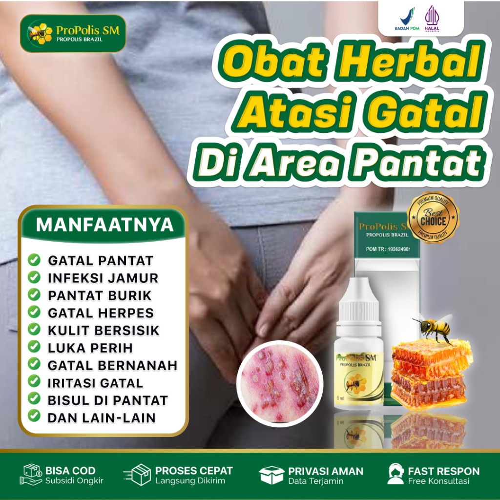 Obat Gatal Di Pantat Gatal Di Bokong Anus Gatal Ruam Merah Propolis SM