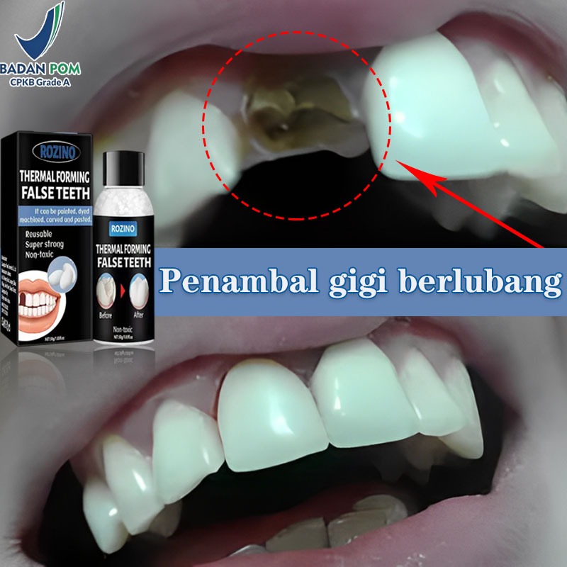 penambal gigi berlubang gigi palsu asli dokter permanen tambal gigi permanen 30g lem gigi palsu perm