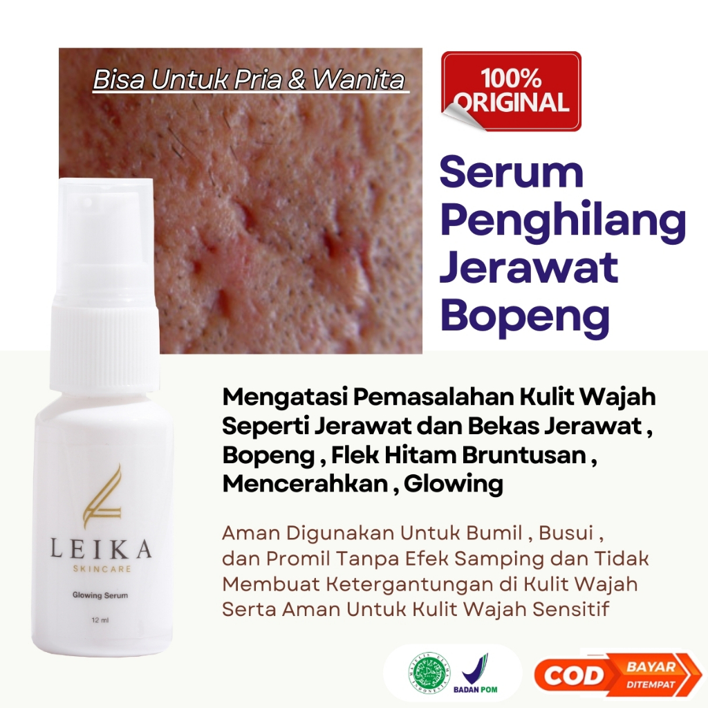 Penghilang bopeng bekas jerawat pria Wanita Menghilangkan bopeng penghilang jerawat penghilang bekas