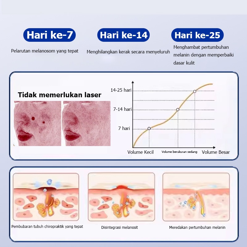 Penghilang tahi lalat penghilang tahi lalat di wajah obat penghilang tahi lalat penghilang tailat