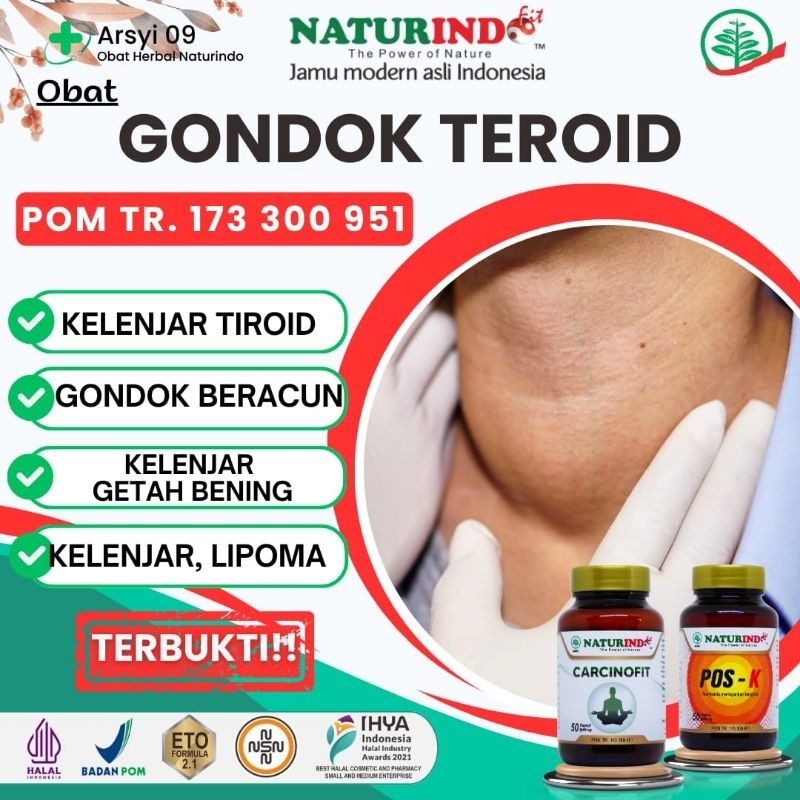 Obat Benjolan Leher Gondok Teroid Hiperteroid Kelenjar Getah Bening Di Leher gondok beracun Hyperter