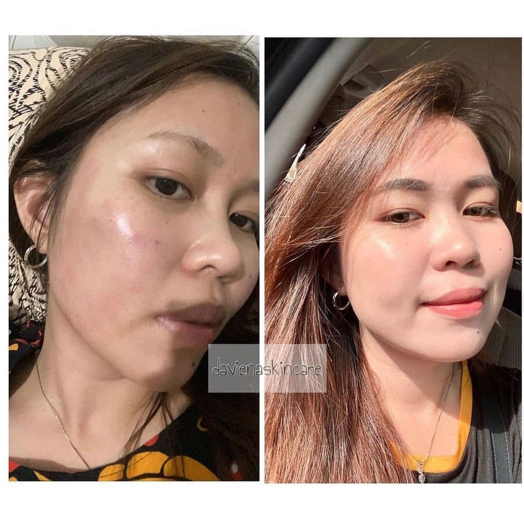 Glowing series Daviena skincare | DAVINA SKINCARE | Davienaskincare | DAVINA SKINCARE | Davienaskinc