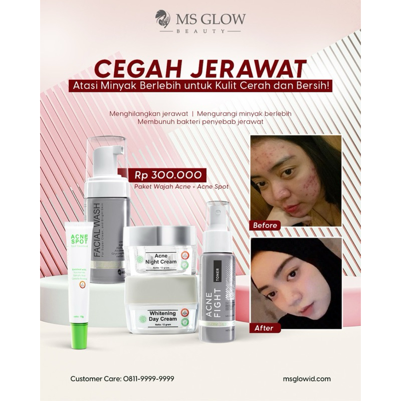 Acne Series  MS GLOW isi 5 dalam 1 paket + pouch exclusice
