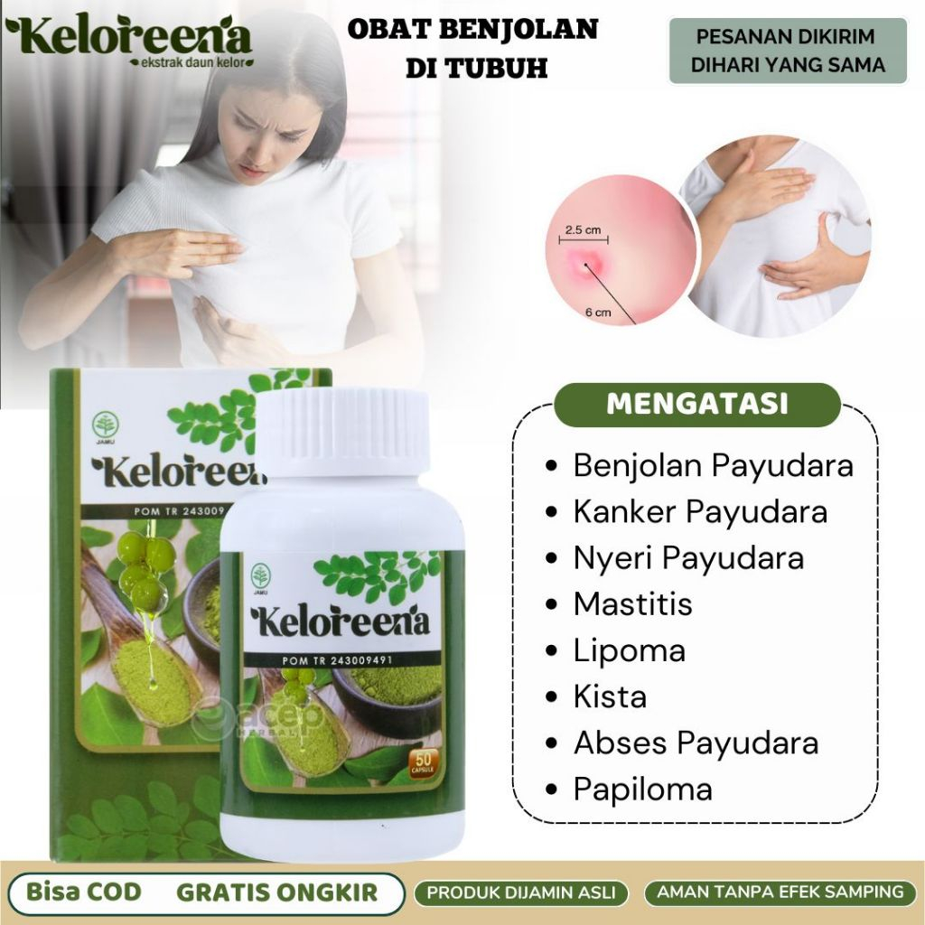 Keloreena Mengatasi Benjolan Payudara Kanker Payudara Stadium 1 Nyeri Payudara Mastitis Lipoma Kelen
