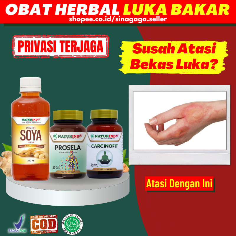 Paket Obat Herbal Penghilang Bekas Luka Hitam Koreng Luka Bakar Melepuh Kena Air Panas Api Obat Kuli