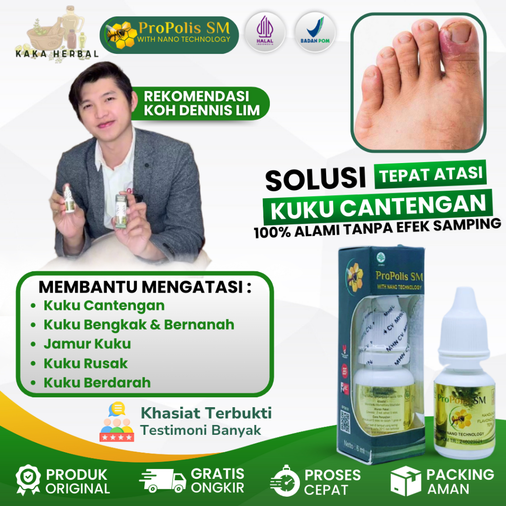 Obat Cantengan Jempol Kaki Tangan Kuku Rusak Bengkak Bernanah Berdarah Kuku Jamuran Herbal Propolis 
