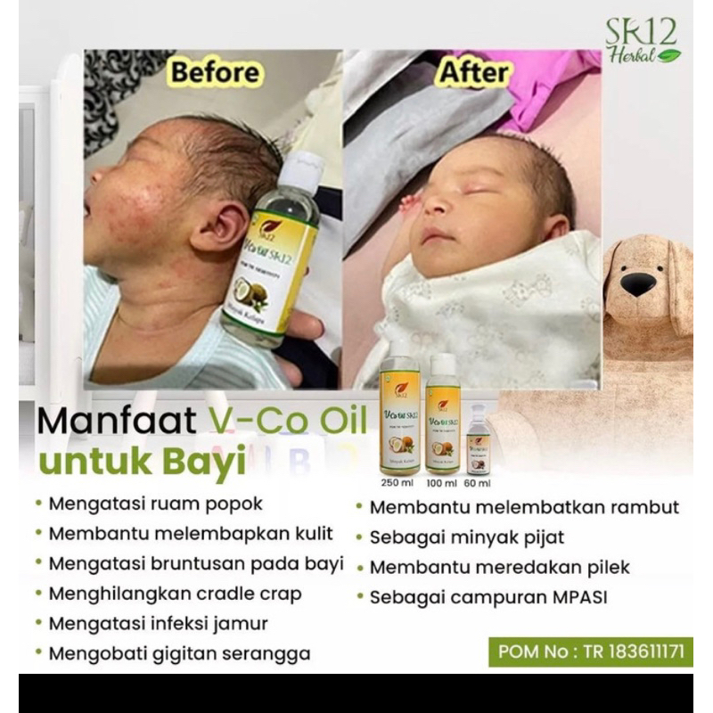 

VCO virgin coconut oil minyak vco