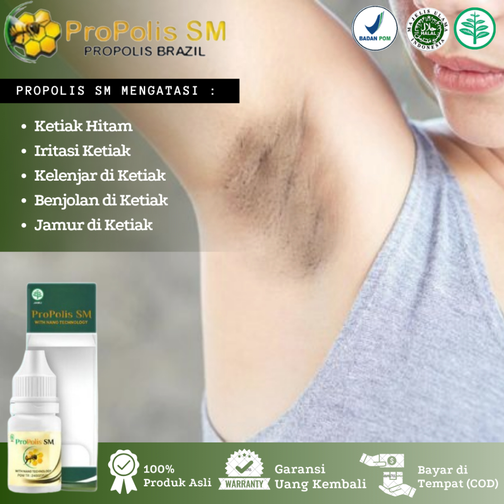 Propolis SM - Salep Oles Atasi Ketiak Hitam, Jamur di Ketiak, Gatal di Ketiak, Ruam Merah di Ketiak,
