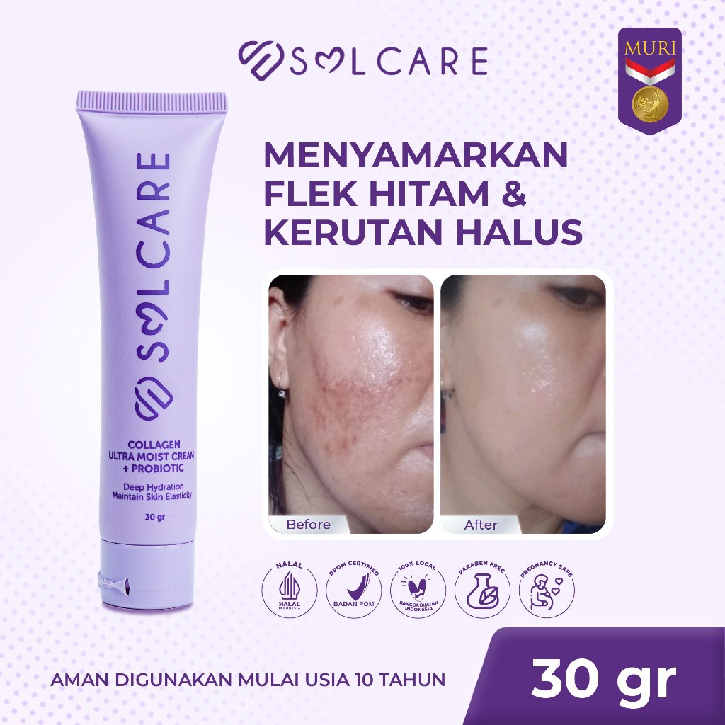 BELI 1 DAPAT 10 Solcare Collagen Ultra Moist Cream + Probiotic – Cream Penghilang Flek