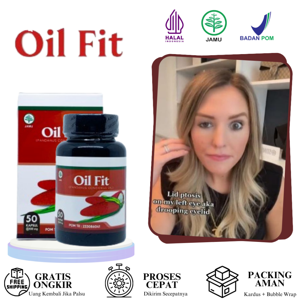 Obat Mata Ptosis Lipatan Kelopak Mata Beda Sebelah Mata Sipit Sebelah Kelopak Mata Turun Sebelah Sar