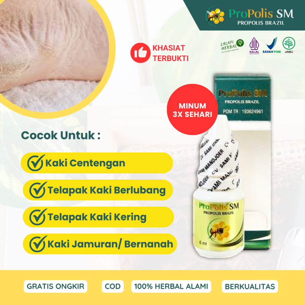 Obat Kaki Centengan Kaki Bengkak Kering Bolong Berlubang Sakit Telapak Kaki Kapalan Pecah Pecah Berj
