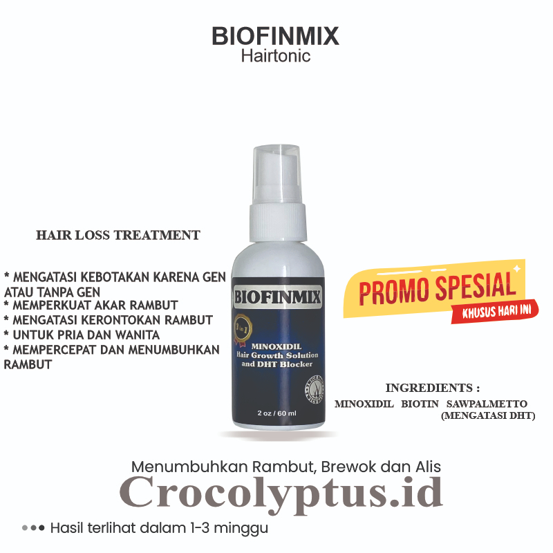 BioFinmix HairGrowth Solution - penumbuh rambut botak M dan mengurangi rambut rontok karena Gen atau