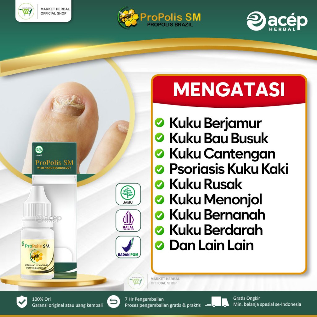 Propolis SM - Obat Kuku Jamur Rusak, Kuku Bau Busuk, Kaki Jamur Rusak Cantengan Jempol Kaki, Psorias