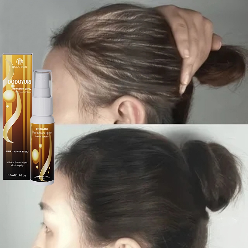 Obat penumbuh rambut hair tonic rambut rontok serum rambut rontok penumbuh rambut cepat 30ml penumbu