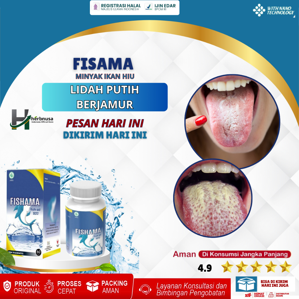 Obat Lidah Putih, Obat Lidah Putih Berjamur, Kandidiasis Mukokutan, Kandidiasis Oral, Infeksi Jamur 