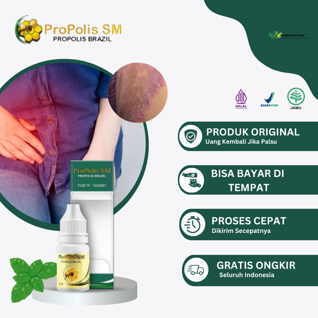 Propolis SM Gatal Selangkangan Hitam, Selangkangan Lecet, Perih, Iritasi Selangkangan, Infeksi Jamur
