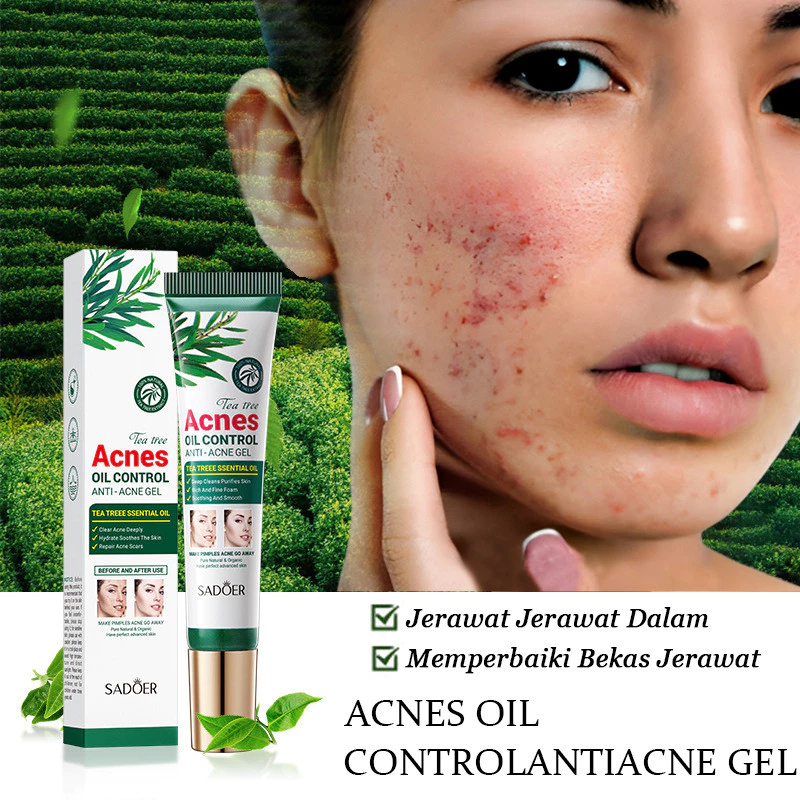 Krim Jerawat Pohon Teh/Krim Jerawat Tanaman Alami Asli Mencerahkan pelembab kulit/Jerawat/Bekas jera