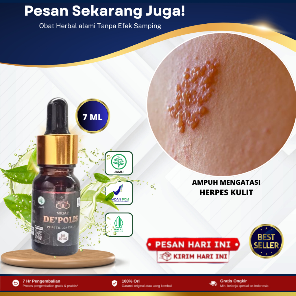 Obat Herpes Kulit, Herpes Herbal, Herpes, Penghilang Herpes, Herpes Kelamin, Herpes Zooster, Herpes 