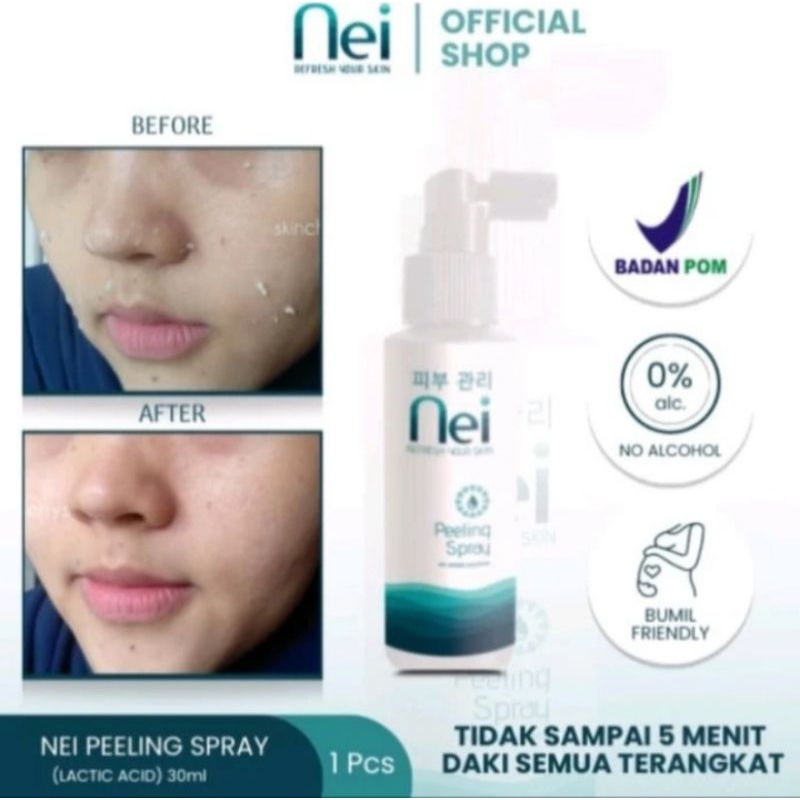 Nei Peeling Spray Penghilang Daki Di Tubuhh | Nei Peeling isi 90ML Asli