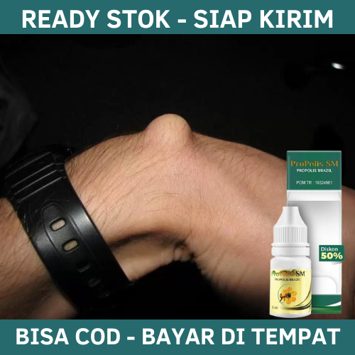 Obat Kista Ganglion, Obat Herbal Kista Ganglion, Obat Penghancur Kista Ganglion, Obat Benjolan Di Ta