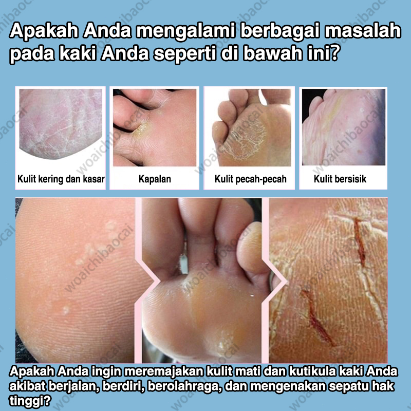 Original Pelembab dan Perawatan Retak Tumit dan cream kaki kapalan Cream kaki pecah Untuk Kulit Kering dan Pecah Perawatan Kulit kaki halus