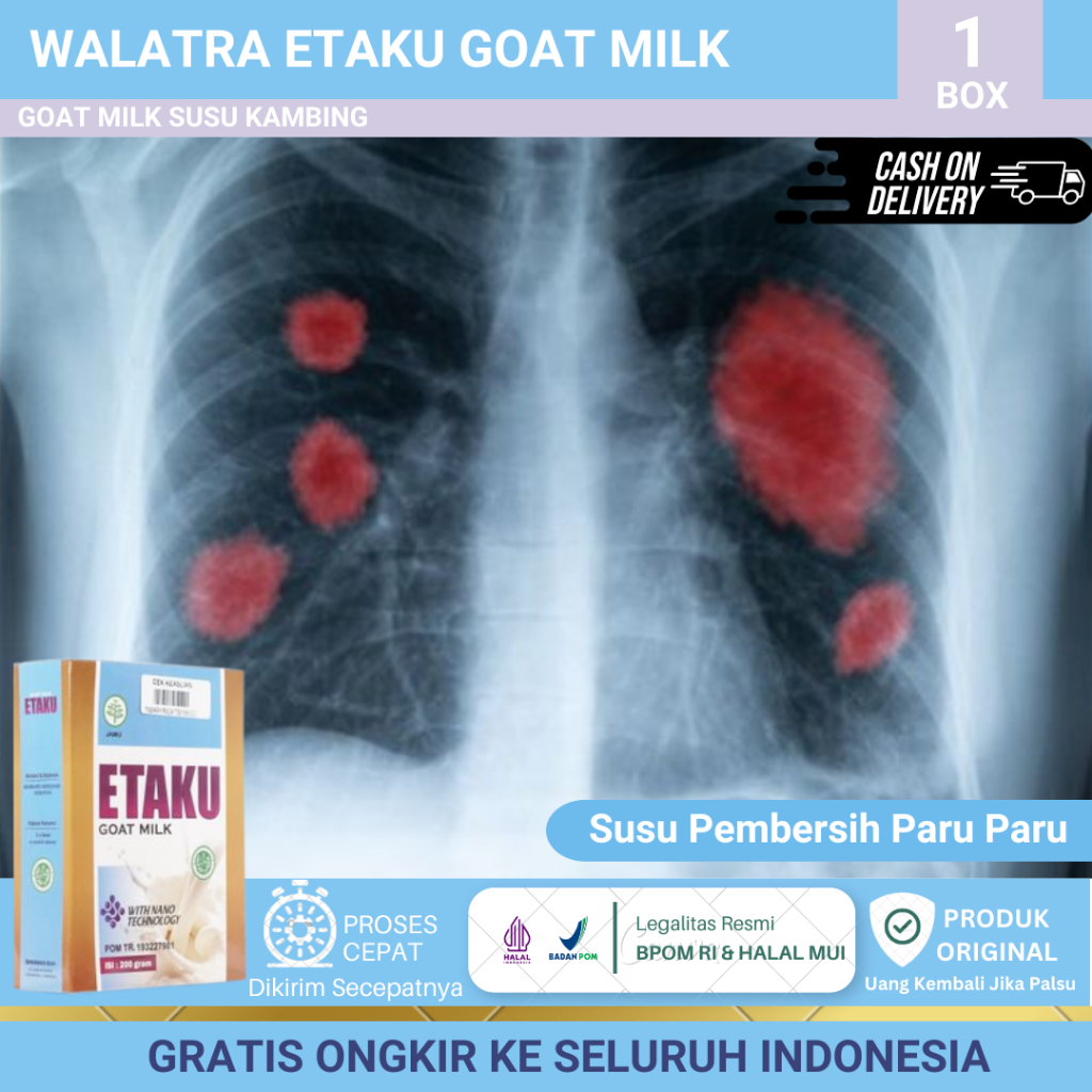 Susu Pembersih Paru Paru, Sakit Paru Paru, Radang Paru Paru, Infeksi Paru Paru Anak, Nyeri Dada Dan 