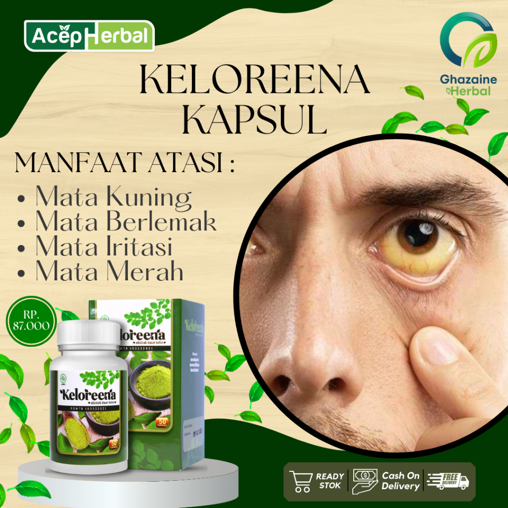Obat Mata Berlemak, Mata Kuning, Mata Iritasi, Mata Merah, Pterygium Atasi Dengan Keloreena