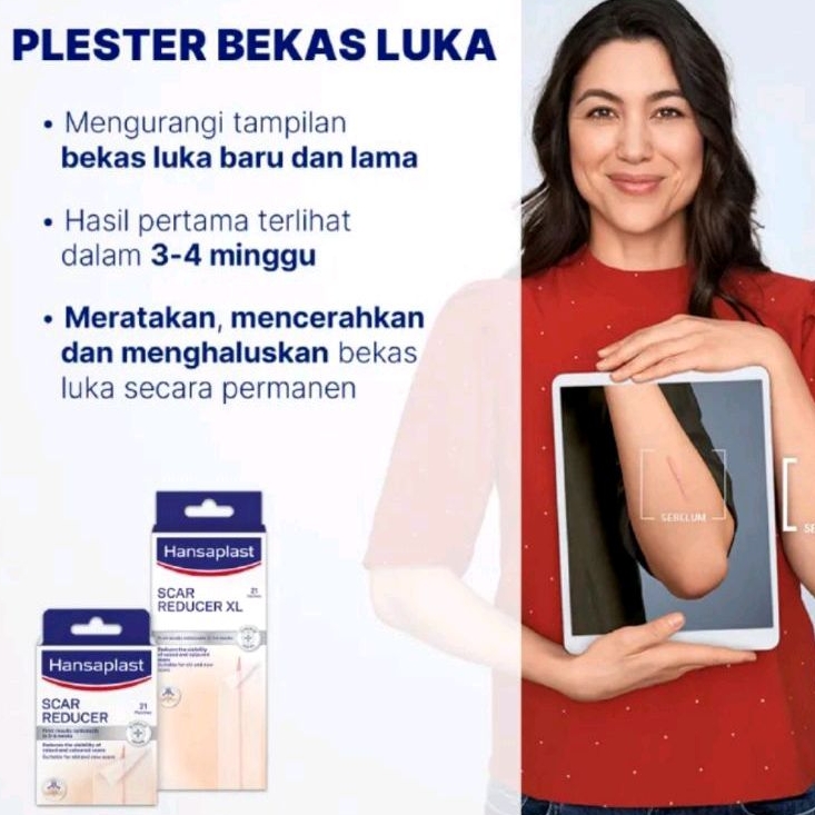 Hansaplast Plester Bekas Luka penghilang Keloid dan bekas Luka Cesar
