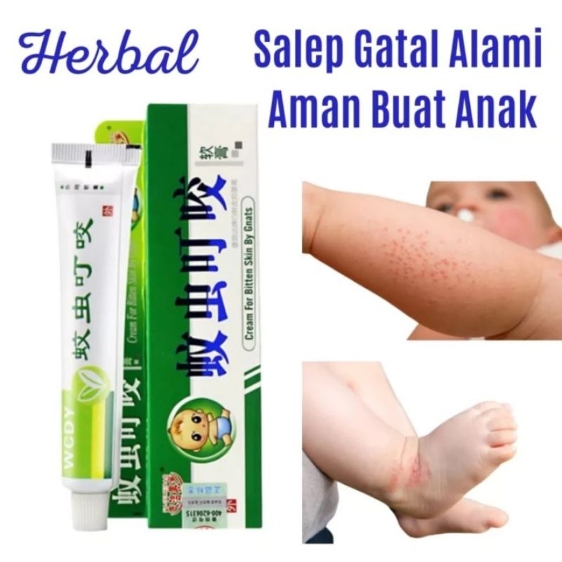 Salep Krim Bayi & Anak / Gatal - Ruam - biang keringat - gigitan serangga Herbal