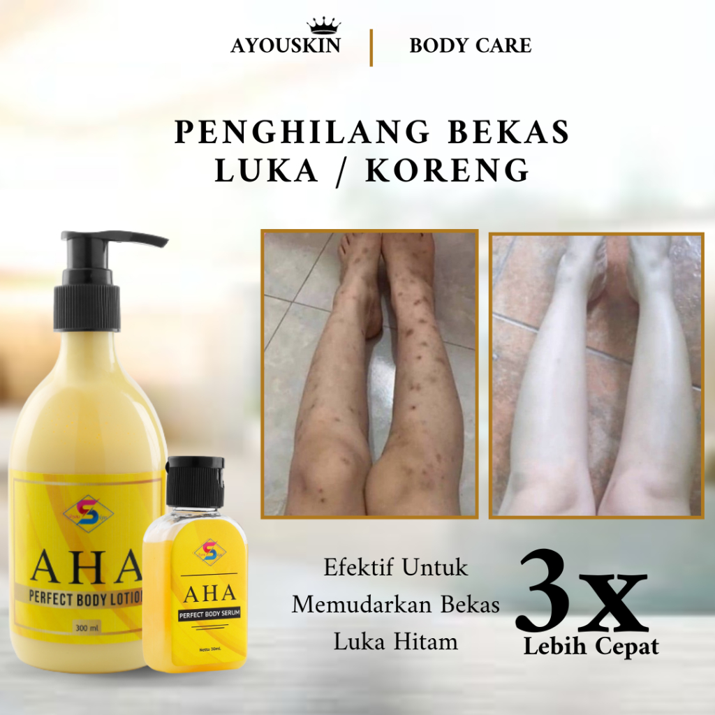 Body Lotion Penghilang Bekas Luka Koreng, Penghilang Koreng Hitam, Cream / Krim Losion Penghilang Be