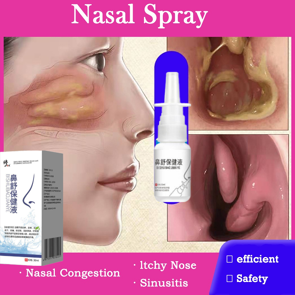 Nasal spray Inhaler asma Pembersih hidung 30ml Obat sinusiti Obat sinusitis paling ampuh