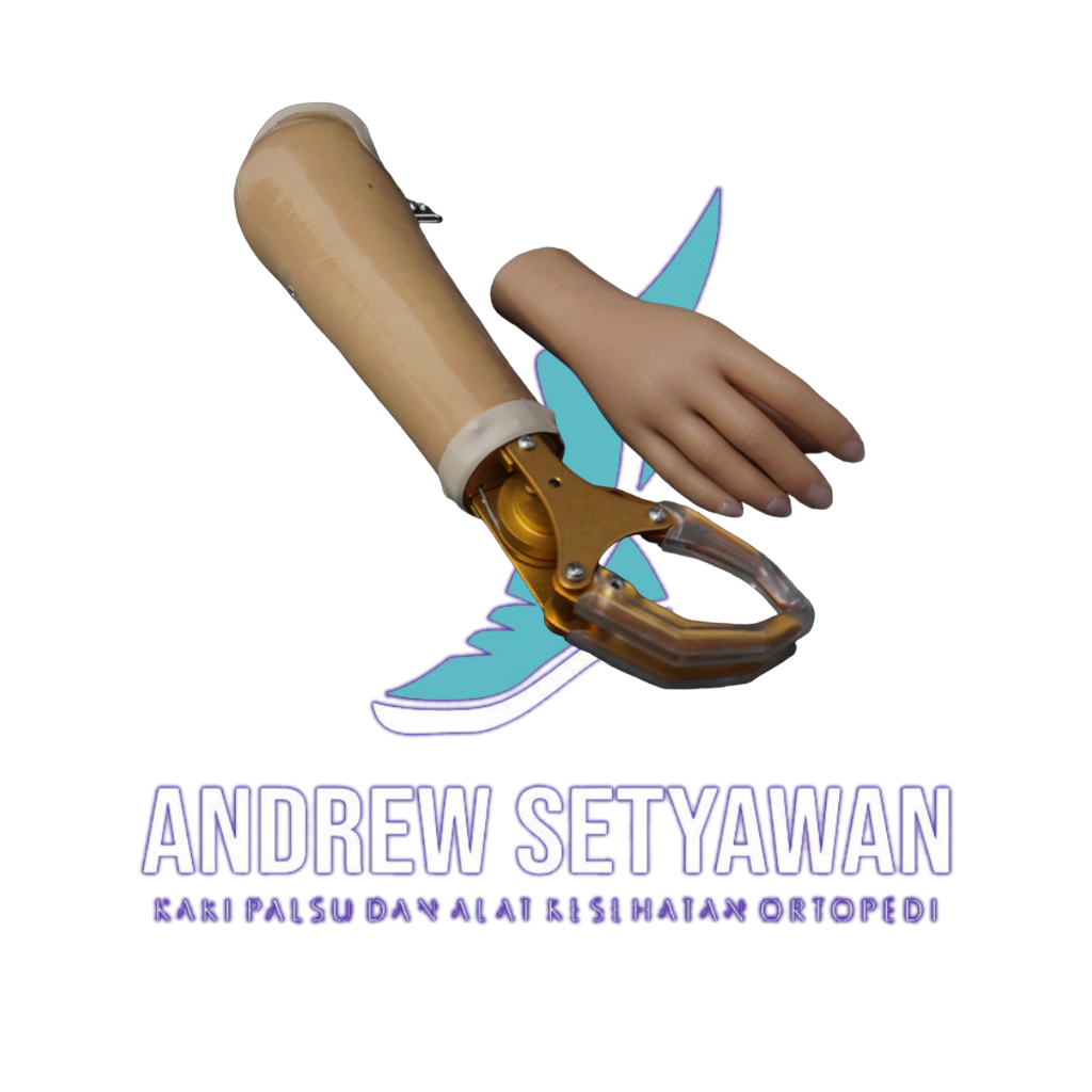 Tangan Palsu Mekanikal
