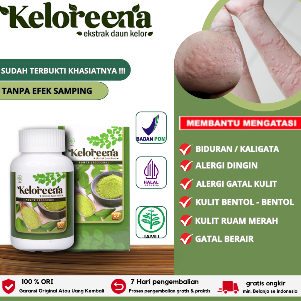 Obat Alergi Dingin Biduran Kaligata, Biduran Menahun , Biduran Kronis, Alergi Makanan, Kulit Gatal, 