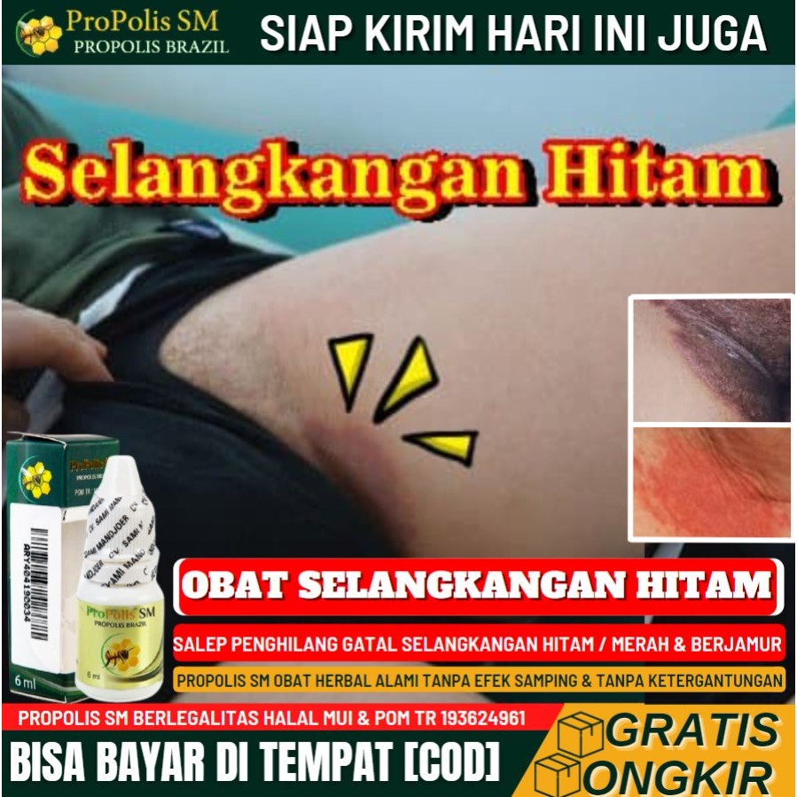 Salep Cair Pemutih Selangkangan Hitam, Penghilang Flek Hitam di Selangkangan, Pemutih Alami Selangka