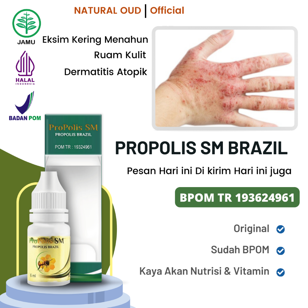 Obat Eksim Kering Menahun, Kulit Kering Gatal, Herbal Dermatitis Atopik, Ruam Kulit, Obat Oles Kulit