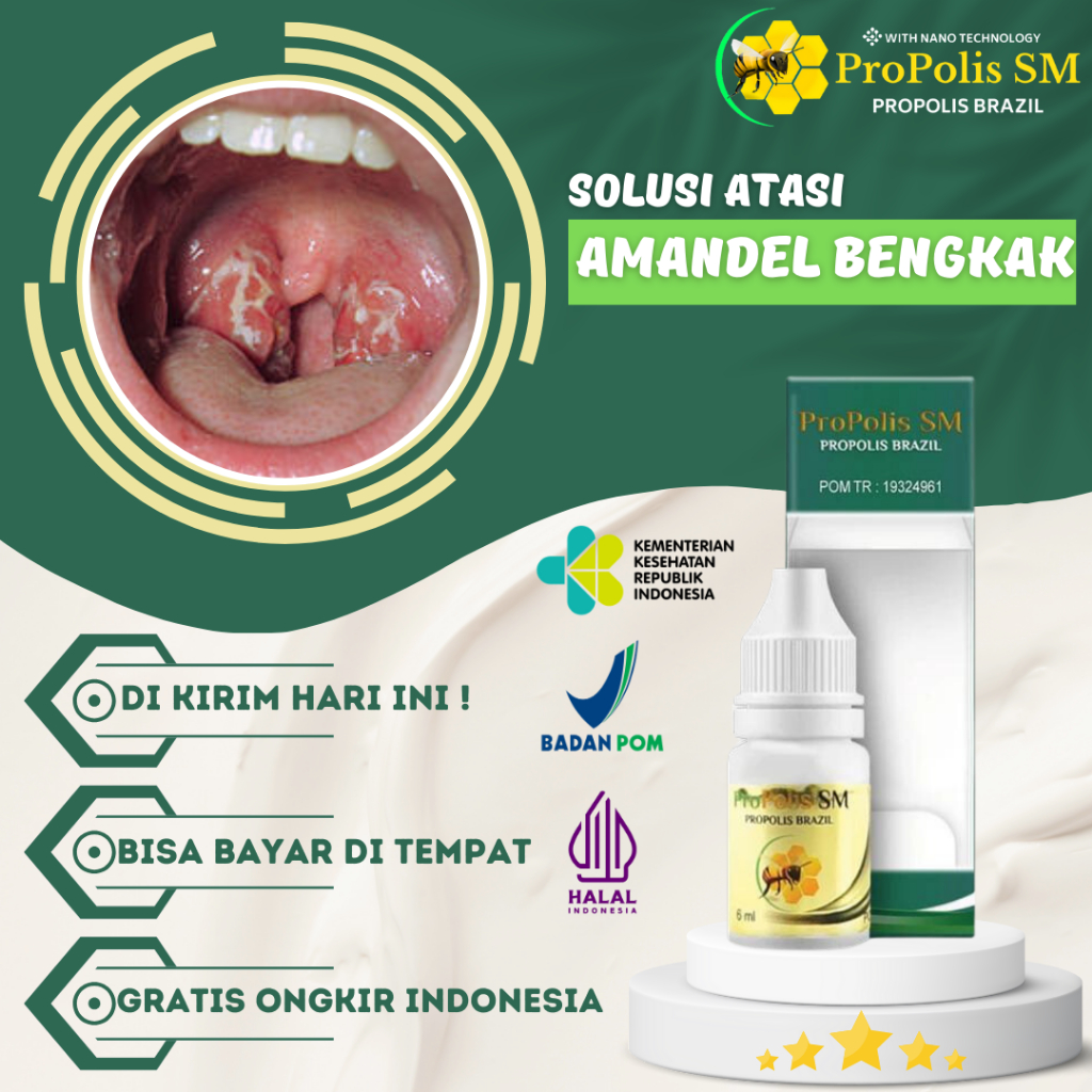Obat Amandel Bengkak, Obat Radang Amandel, Obat Sakit Amandel, Obat Pegempis Amandel, Obat Sakit Ten