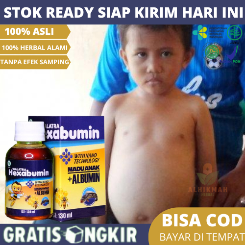 Obat Hisprung Pada Anak, Bayi & Balita, Perut Bengkak, Sembelit Susah BAB, Radang Usus, Gastritis, G
