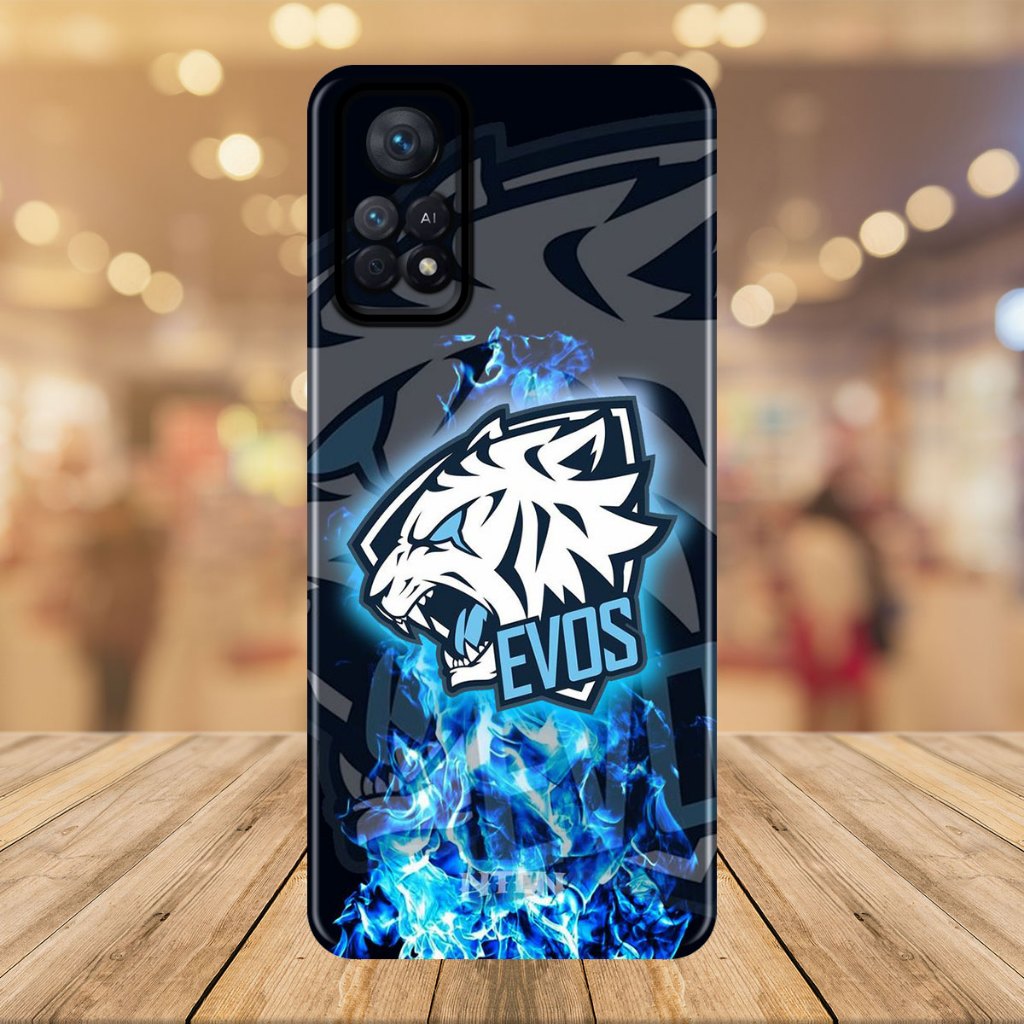 Case REDMI NOTE 11 PRO Casin g Hp - Softcase Case  REDMI NOTE 11 PRO Casing Hp - Softcase - Case Hp 