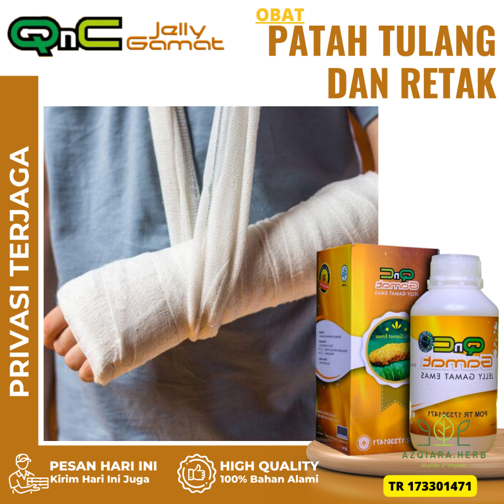 Obat Patah Tulang Dan Retak, Obat Patah Tulang Untuk Anak / Dewasa, Obat Pemulihan Patah Tulang, oba